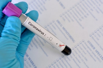 На Буковине обнаружили 87 новых случаев коронавируса за сутки